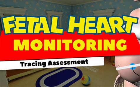 fetal monitoring game